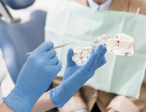 Save_the_tooth_or_get_an_implant