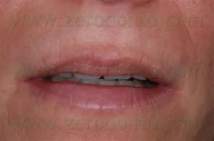 Restore your face with a youthful appearance.