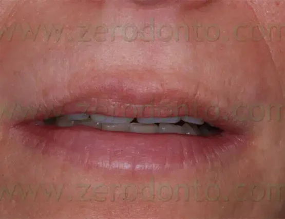 Restore your face with a youthful appearance.