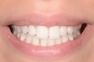 invisible orthodontics